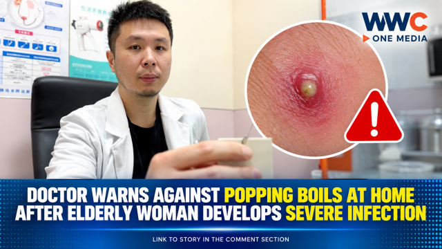 Doctor Warns Against Popping Boils at Home After Elderly Woman Develops Severe Infection